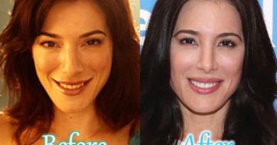 Jaime Murray Plastic Surgery