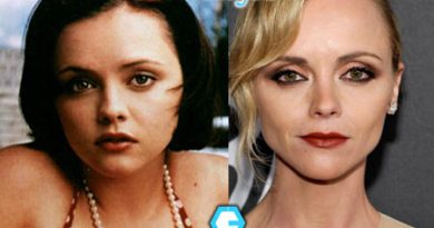 Christina Ricci Nose Job