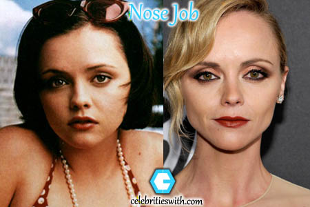 Christina Ricci Nose Job