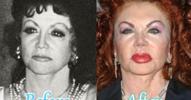 Jackie Stallone Plastic Surgery