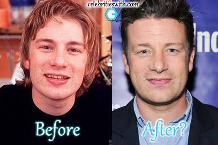 Jamie Oliver Plastic Surgery Rumor