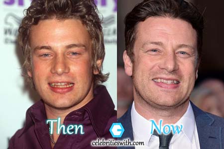 Jamie Oliver Plastic Surgery Photo Jamie Oliver Plastic Surgery