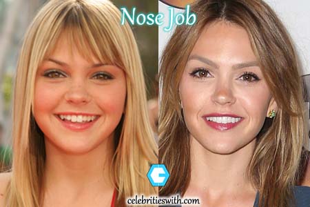 Aimee Teegarden Nose Job