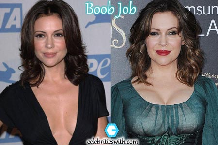 Alyssa Milano Breasts Implant