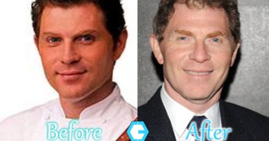 Bobby Flay Plastic Surgery