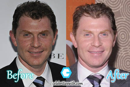 Bobby Flay Plastic Surgery Bobby Flay Plastic Surgery Botox