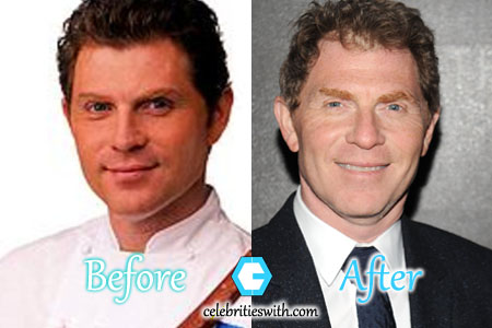 Bobby Flay Plastic Surgery