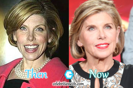 Christine Baranski Plastc Surgery Facelift Christine Baranski Facelift