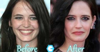 Eva Green Plastic Surgery