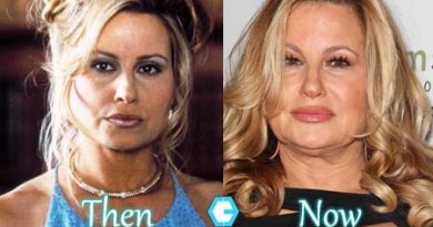 Jennifer Coolidge Facelift, Fillers Photo