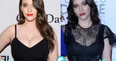 Kat Dennings Plastic Surgery