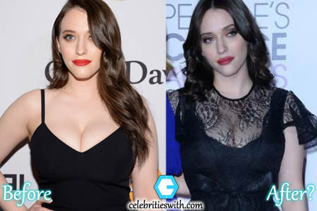 Kat Dennings Plastic Surgery