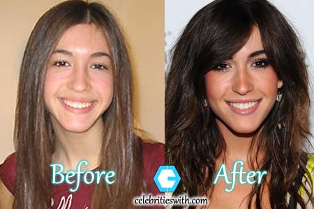 Kate Voegele Plastic Surgery