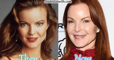 Marcia Cross Botox