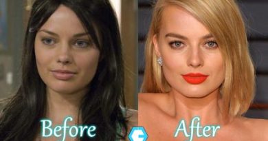 Margot Robbie Plastic Surgery