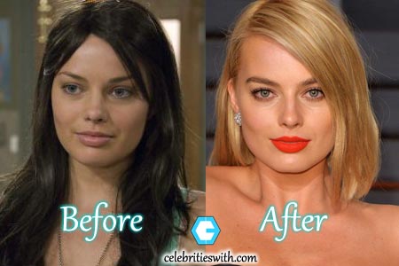 Margot Robbie Plastic Surgery