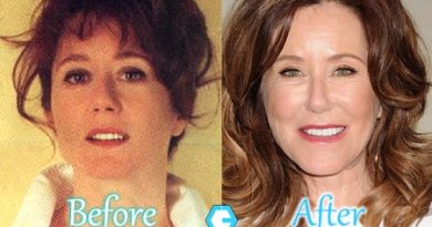 Mary McDonnell Plastic Surgery