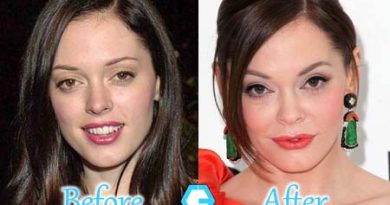 Rose McGowan Plastic Surgery