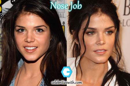 Marie Avgeropoulos Nose Job