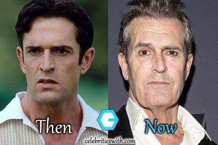 Rupert Everett Plastic Surgery Photo Rupert Everett Plastic Surgery, Facelift