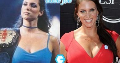 Stephanie Mcmahon Boob Job Photo