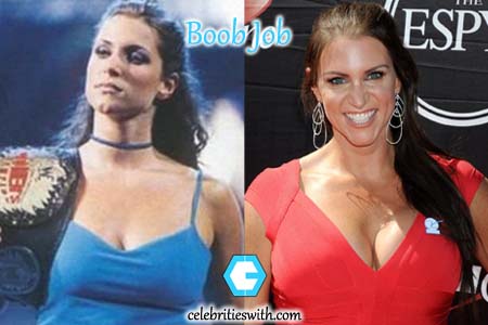 Stephanie mcmahon breast. 