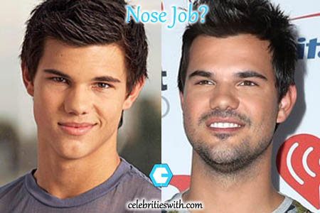 Taylor Lautner Nose Job