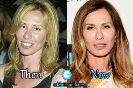 Carole Radziwill. 