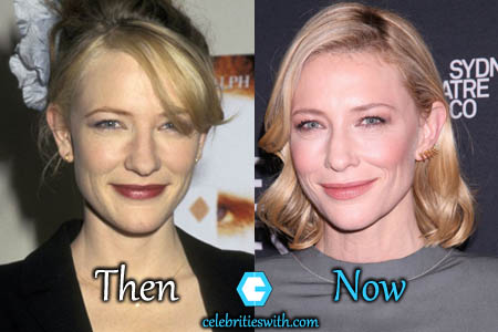 Cate Blanchett Facelift Cate Blanchett Facelift