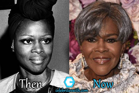 Cicely Tyson Facelift Cicely Tyson Facelift
