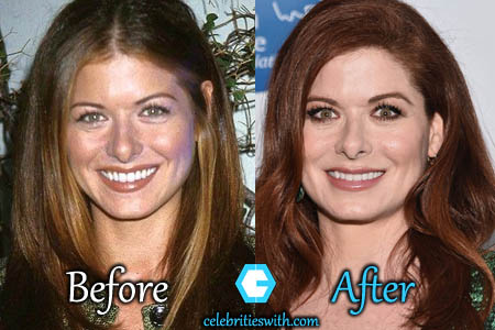 Debra Messing Nose Job Photo Debra Messing Nose Job