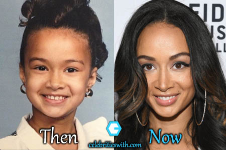 Draya Plastic Surgery, Before and After