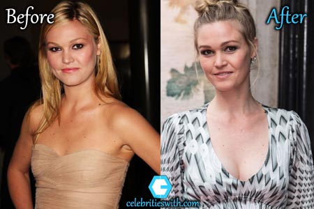 Julia Stiles Plastic Surgery Julia Stiles Plastic Surgery, Boob Job