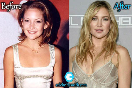 Kate Hudson Boob Job Kate Hudson Boob JobKate Hudson Boob Job