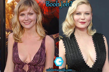 Is Kirsten Dunst boob job true? 