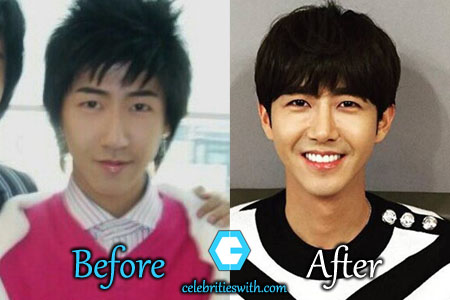 Kwang-Hee-Plastic-Surgery-Picture.jpg