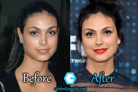 Morena Baccarin Plastic Surgery Morena Baccarin Plastic Surgery