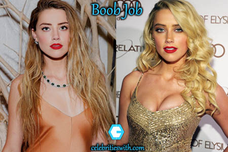Amber Heard Boobs Job