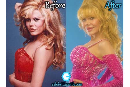 Charo Boob Job Charo Boob Job