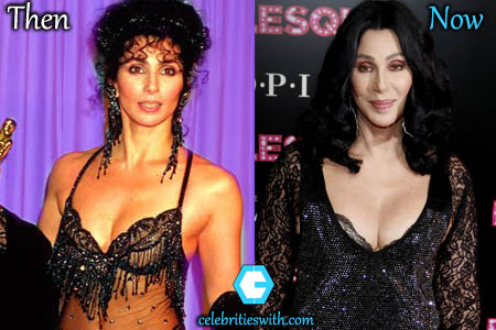 Cher Boob Job Cher Boob Job