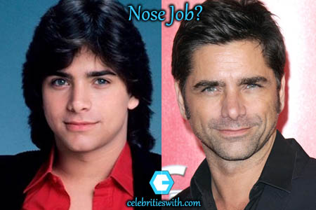 John Stamos Nose Job John Stamos Nose Job