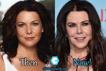Lauren Graham Botox Lauren Graham Botox