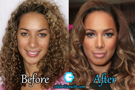 Leona Lewis Nose Job Leona Lewis Nose Job
