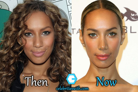 Leona Lewis Plastic Surgery, Botox, Then and Now Photo.