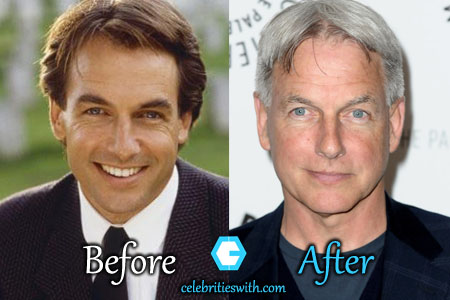 Mark Harmon Plastic Surgery Mark Harmon Plastic Surgery