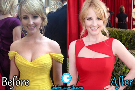 Melissa Rauch Boob Job Melissa Rauch Boob Job