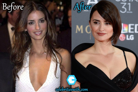 Penelope Cruz Breast Implants Penelope Cruz Breast Implants