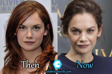 Ruth Wilson Facelift Ruth Wilson Facelift