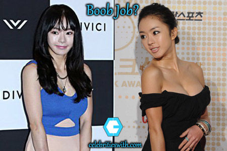 Seo Woo Breasts Seo Woo Surgery