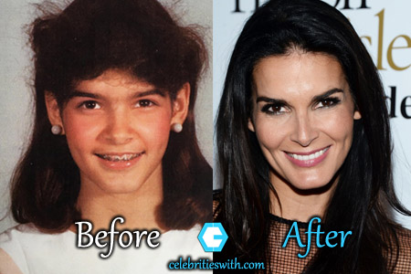 Angie Harmon Plastic Surgery Angie Harmon Plastic Surgery